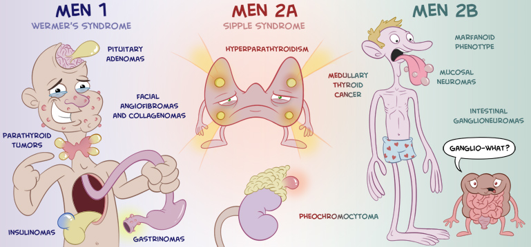 Sindromi Poliendocrine - MEN